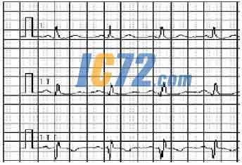 ic72新闻中心